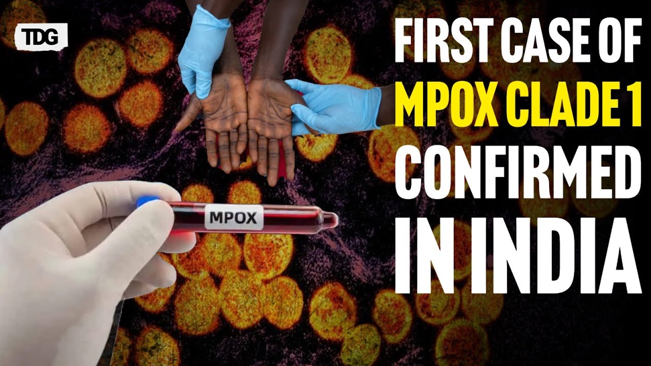 India Confirms First Case of Mpox Clade 1 Infection: Here's What You ...