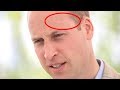 Why does Prince William have a Harry Potter style scar on his head?