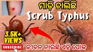 Deadly Scrub Typhus Disease Spread In Odisha Biobooster Academy