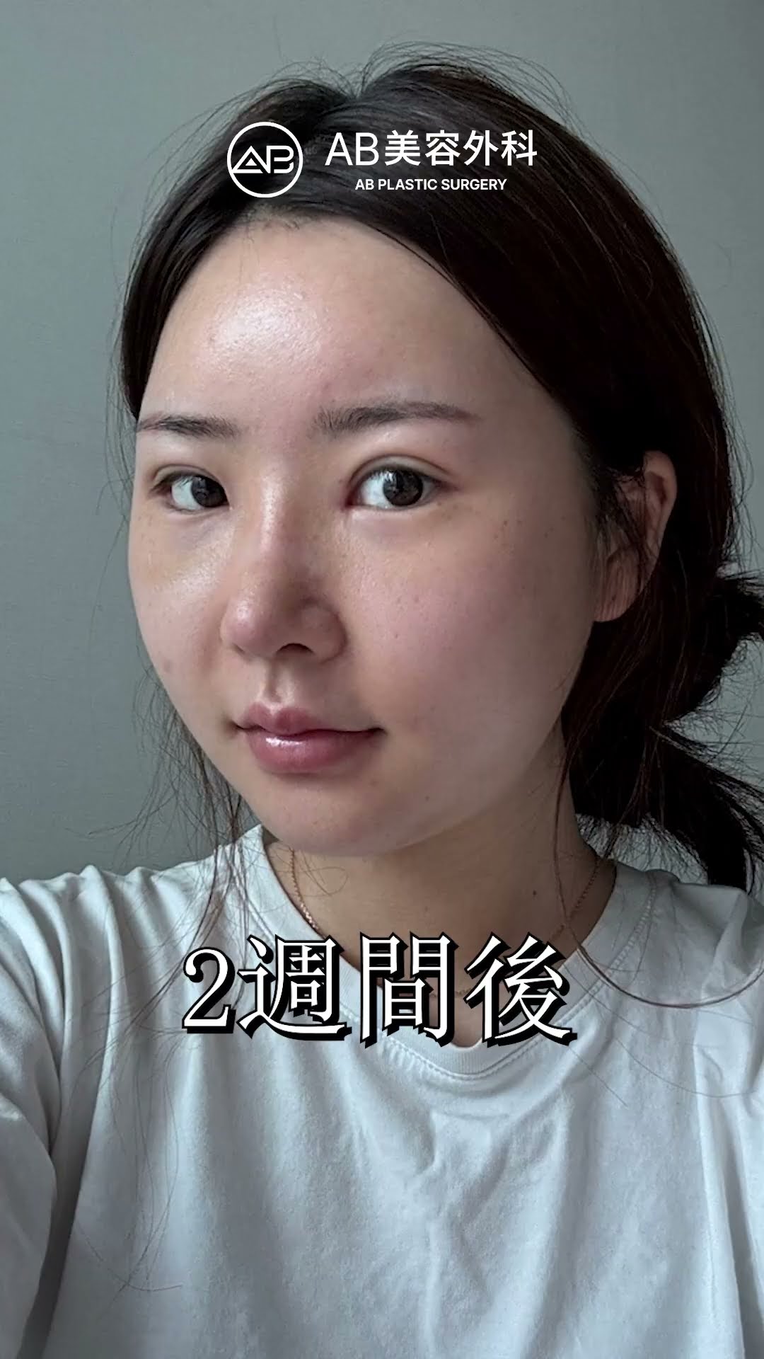 顔の印象が一気に変わった