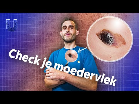 Video: Hoe herken je inslagkraters?