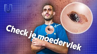 Hoe herken je huidkanker?