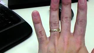 Wasp sting