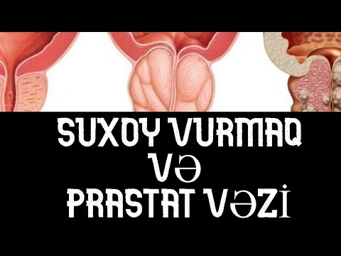 SUXOY vurmaq və PRASTAT Vəzi ( TƏSİRİ )