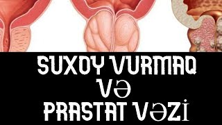 SUXOY vurmaq və PRASTAT Vəzi ( TƏSİRİ )