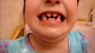 OMG !!  My Child, HAS BATMAN TEETH!
