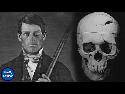 Vomiting Up Brain? A Fungus in his Skull? The Gruesome Story of Phineas Gage | Well, I Never 