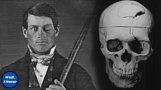 Vomiting Up Brain? A Fungus in his Skull? The Gruesome Story of Phineas Gage | Well, I Never