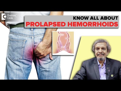 Hemorrhoids|Prolapsed Hemorrhoids|Types of Hemorrhoids & Treatment -Dr.Rajasekar M R|Doctors' Circle