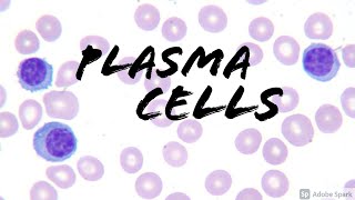 Plasma Cells on Peripheral Blood Smear (Hemepath Hematology Pathology) screenshot 5