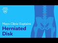 Mayo clinic explains herniated disk