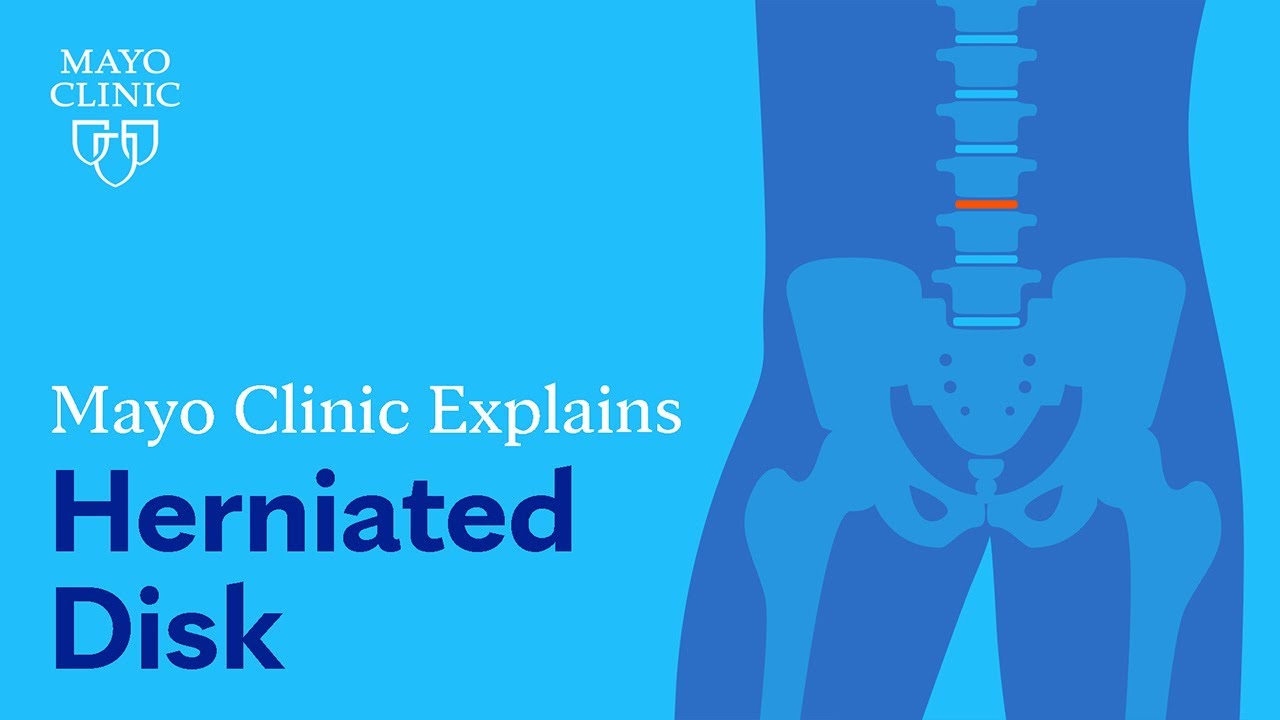 Lumbar Disc Herniation: what it is, symptoms and treatment