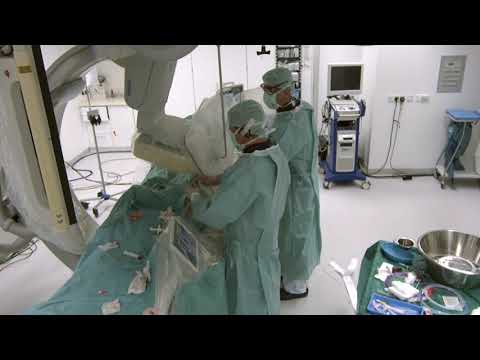 Stern D2 - Live Case - Occlusion of the PTA in a CLI Patient - Leipzig, Germany