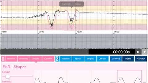CTGi Version 3 Preview