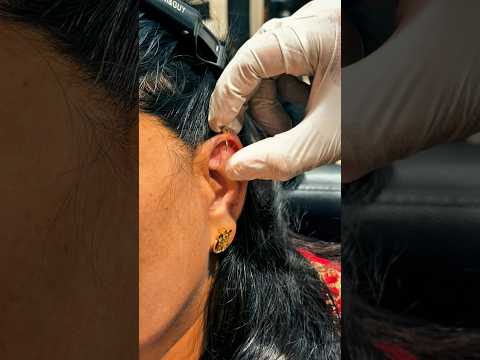 Ready for a new look? Our experts at 21 ink d zone. #ProfessionalPiercing #helixpiercing