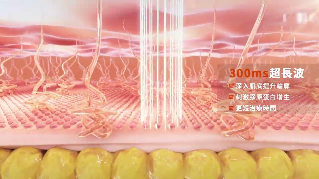 Cynosure® Elite 5D胶原光焕肤护理| MÍOGGÍ｜医学轻龄专家｜香港医学