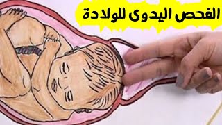 فحص 《 توسع عنق الرحم للولادة #الكشف المهبلى لفحص الحوض 》أسراره ولماذا يتم و هل مؤلم ⁉️د. ريهام الشال