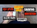 How To Deal with Shaving Irritation - Nicks Cuts Razor Burn Bumps Ingrown Hairs