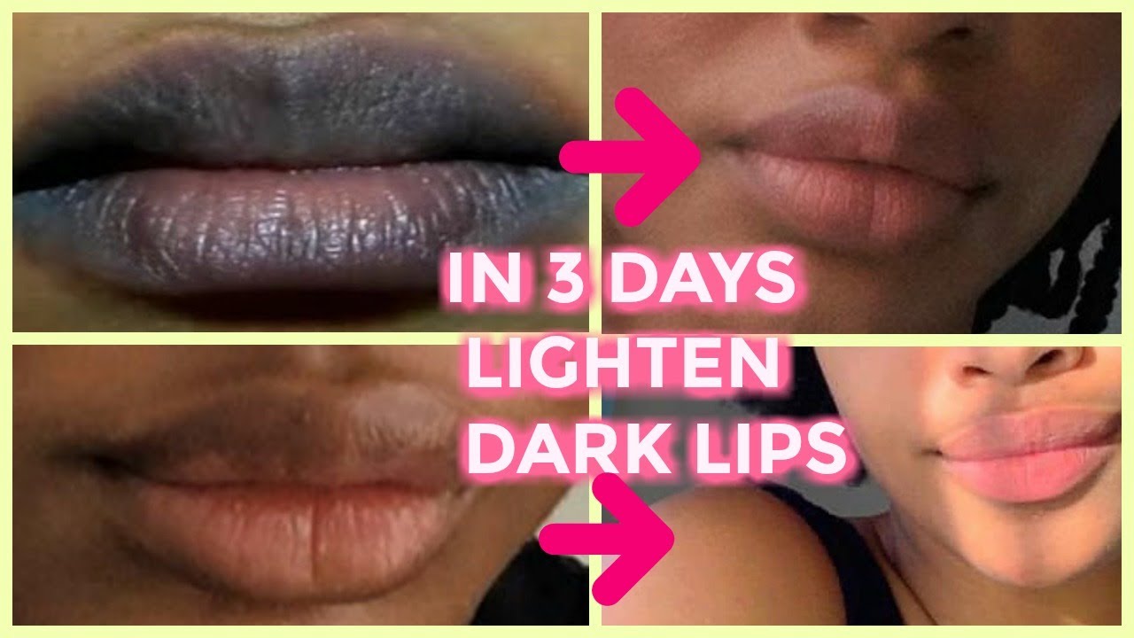 Get dark lips lighten & Pink in 3 days, your lips will be Soft Plum 2