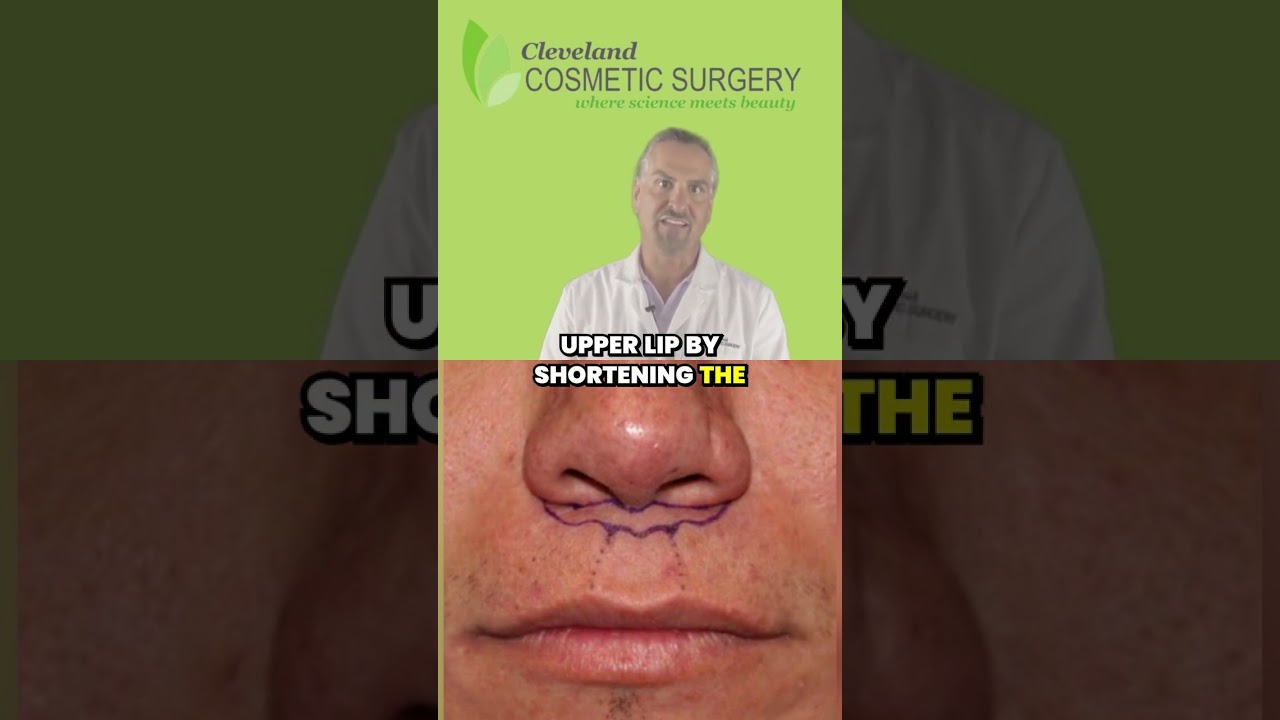 What is a Surgical Lip Lift?