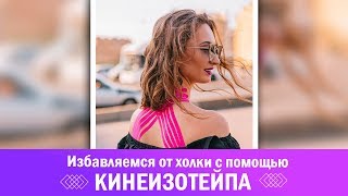 Избавляемся от холки с помощью кинезиотейпа. Кинезиотейпирование спины