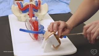 Alternative Strategies for Challenges in Veno Arterial ECMO Cannulation 03 1