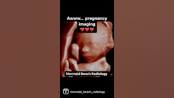 3D/4D foetal imaging on ultrasound