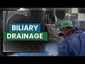 تصريف القناة الصفراوية مع إدخال دعامة إجراء الأشعة التداخلية