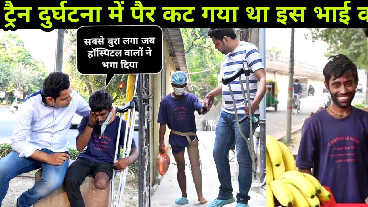 इस भाई को अब कभी रोना नहीं पड़ेगा / ना ही भीख मंगनी पड़ेगी # helpthem