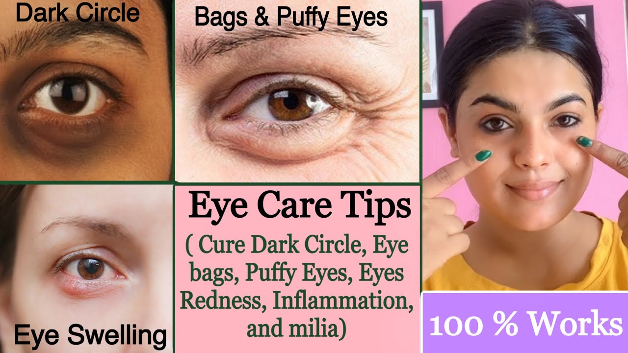 Naturally 💕 Eyes Care Tips CURE* Puffy Eyes, Eye bags, Dark Circles