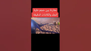 مقارنة بين حجم خلية الجلد والكائنات الدقيقة د محمدأشرف جلديه وليزر 