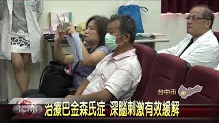 大台中新聞-治療巴金森氏症 深腦刺激有效緩解