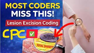 Most Coders Get This Wrong! Lesion Excision Coding for CPC Exam