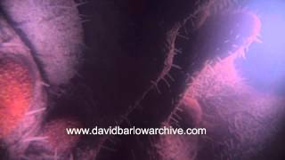 Cervical Crypt by David Barlow 18,108 views 9 years ago 32 seconds