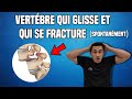 TRAITEMENT DU SPONDYLOLISTHÉSIS LOMBAIRE : EXERCICE KINÉ