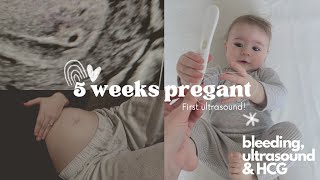 First Trimester Vlog, 5 Weeks Pregnant! First ultrasound, HCG Levels, Symptoms & Bumpdate