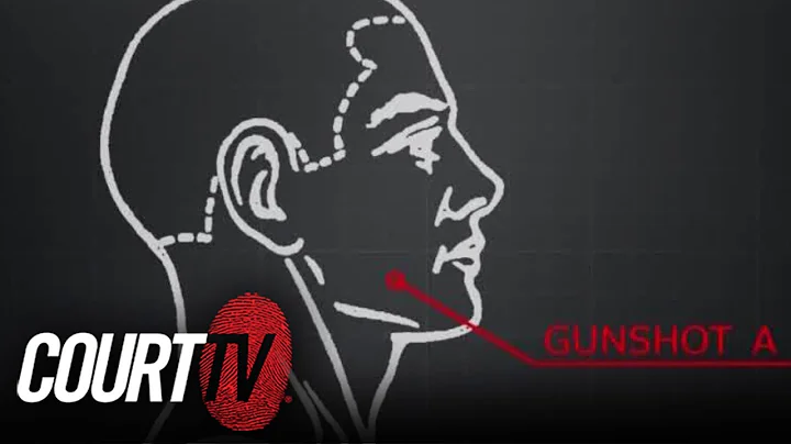 Sleeping Husband Murder Trial: Forensic Pathologis...