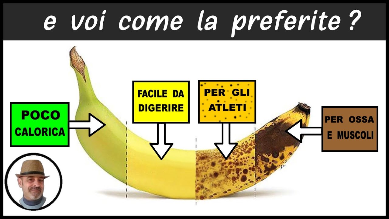 La guidoline: comment la choisir? – La Banane 🍌