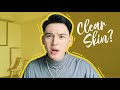 How do you maintain a clear skin? | #AskSky Episode 4