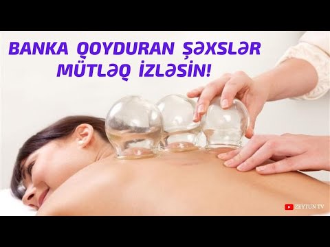 Video: Skotomaya necə diaqnoz qoymaq olar?