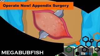 Bubfish Gets His Appendix Out Operate Now Appendix Surgery