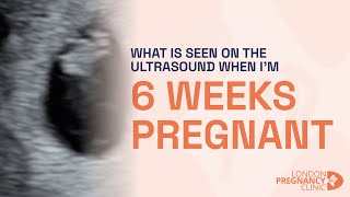 6 Weeks Pregnant: Witnessing the First Heartbeat on ultrasound scan Resimi