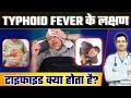 Typhoid Ke Lakshan Typhoid Fever Symptoms Typhoid Kya Hota Hai Typhoid Vaccine Cost Typhoid Ke Lakshan Typhoid Fever Symptoms Typhoid Kya Hota Hai Typhoid Vaccine Cost