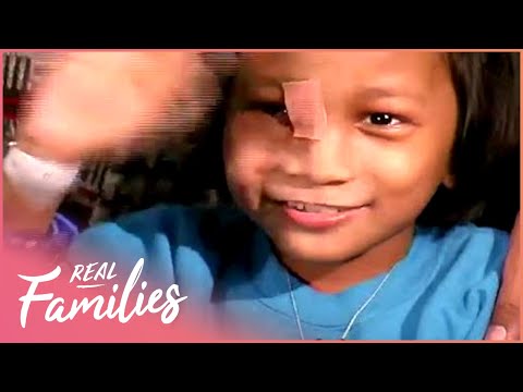 REAL FAMILIES: INSPIRING FACIAL RECONSTRUCTION STORY