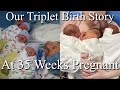 The Triplets’ Birth Story!!