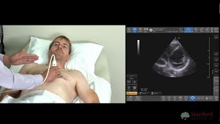 Common Mistakes in Point of Care Cardiac Ultrasound (Echocardiography, POCUS)