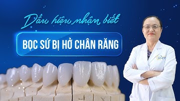9 Dấu hiệu nhận biết Bọc Răng Sứ bị hở chân răng là gì? #NhaKhoaHappy
