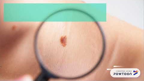 Computer Vision Based Derma Monitoring Application