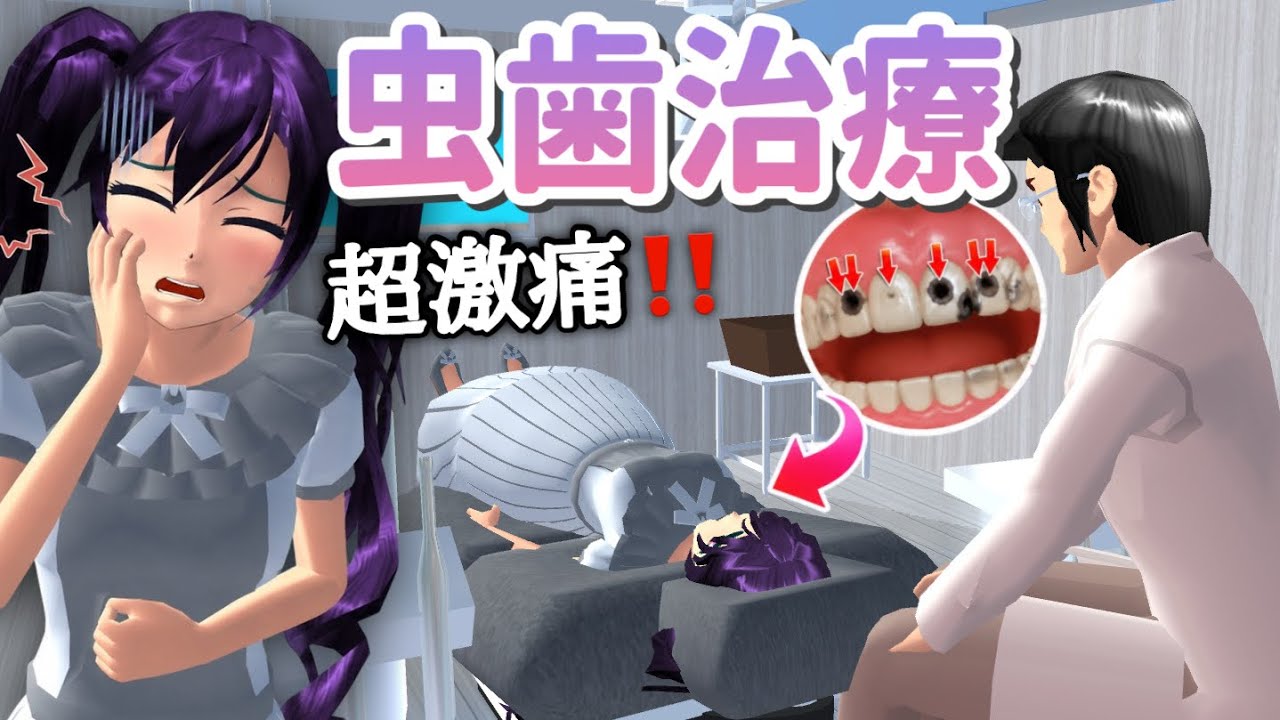 【サクシミュ】虫歯が4本で激痛なので歯医者に行って治療してきました🦷「サクラスクールシミュレーター」