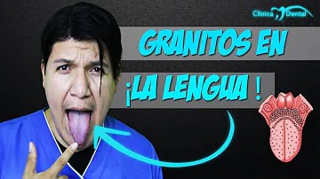 ¿Pueden aparecer granos en la lengua?